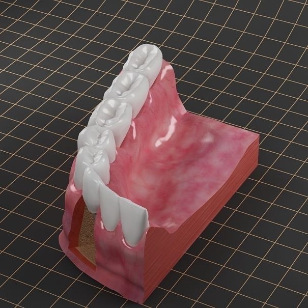 Dental Implant 3D Model – PBR Animated Medical Asset, FBX & OBJ - View 5
