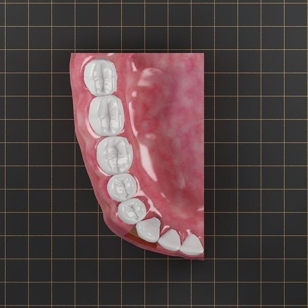 Dental Implant 3D Model – PBR Animated Medical Asset, FBX & OBJ - View 8