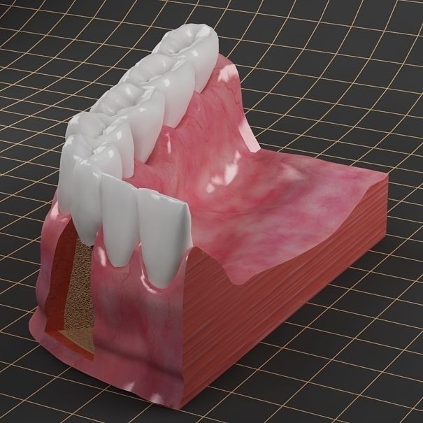Dental Implant 3D Model – PBR Animated Medical Asset, FBX & OBJ - View 9
