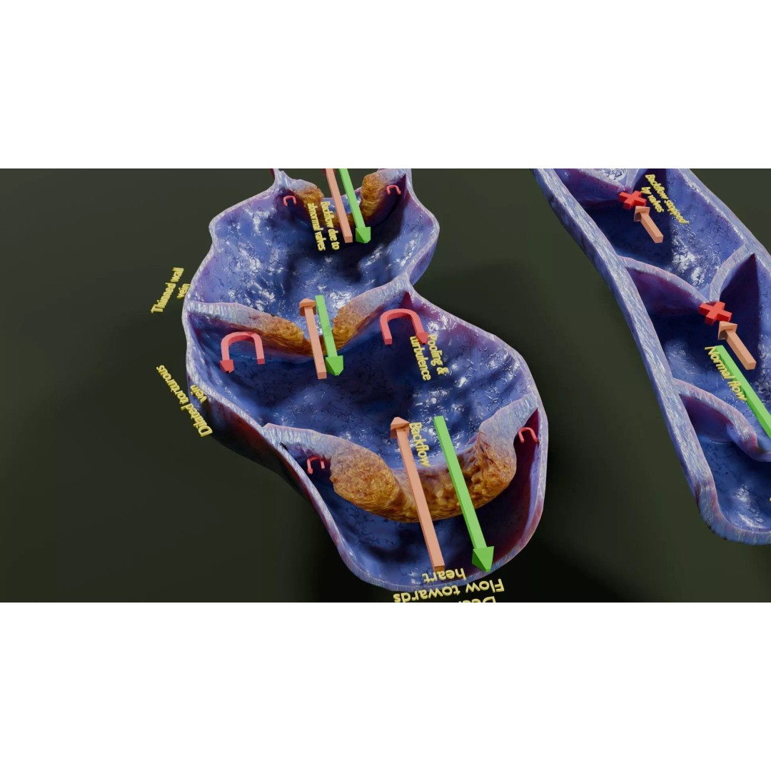 Varicose Vein Valve 3D Model – Low Poly Medical Asset, PBR Textures - View 14