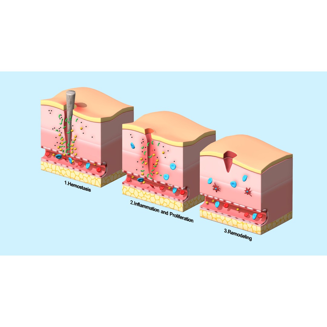 Skin Wound Healing 3D Model – Low Poly Medical Asset, FBX, Blender