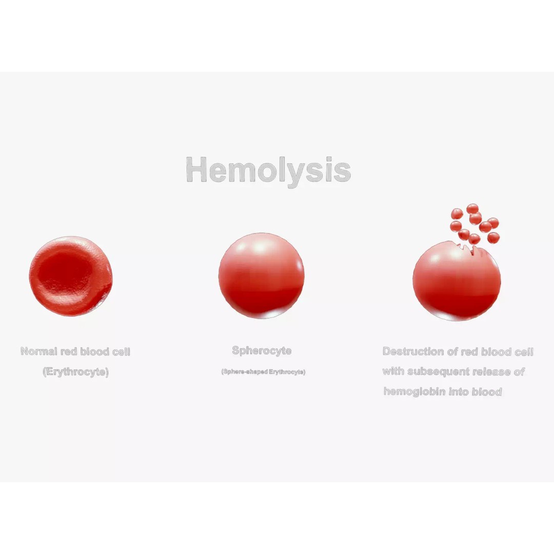 Hemolysis 3D Model – PBR Medical Asset, FBX, OBJ, Blender - View 2
