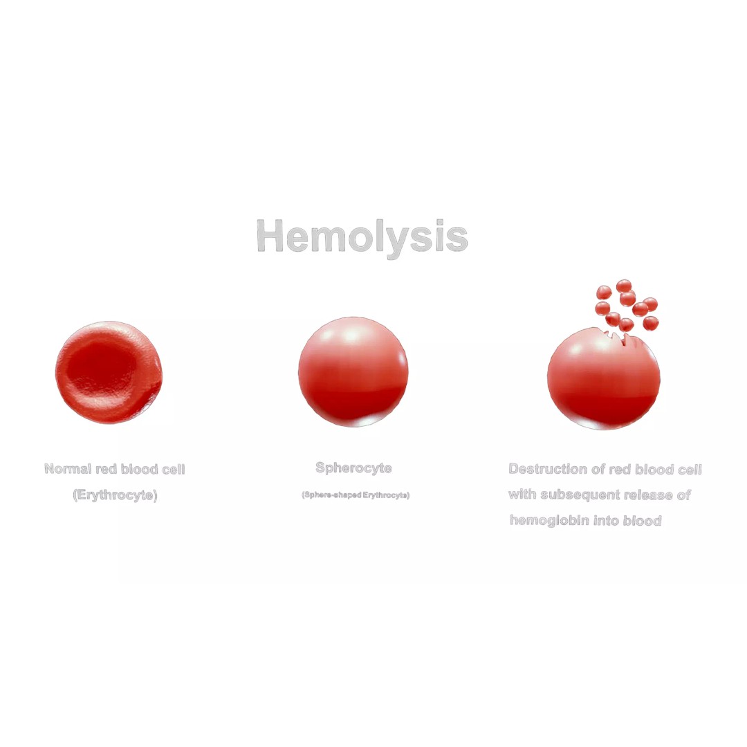 Hemolysis 3D Model – PBR Medical Asset, FBX, OBJ, Blender - View 4