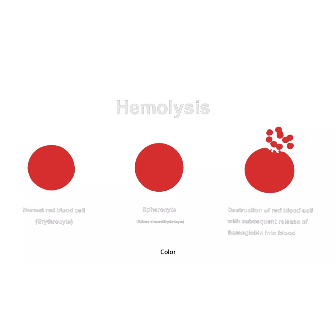 Hemolysis 3D Model – PBR Medical Asset, FBX, OBJ, Blender - View 5