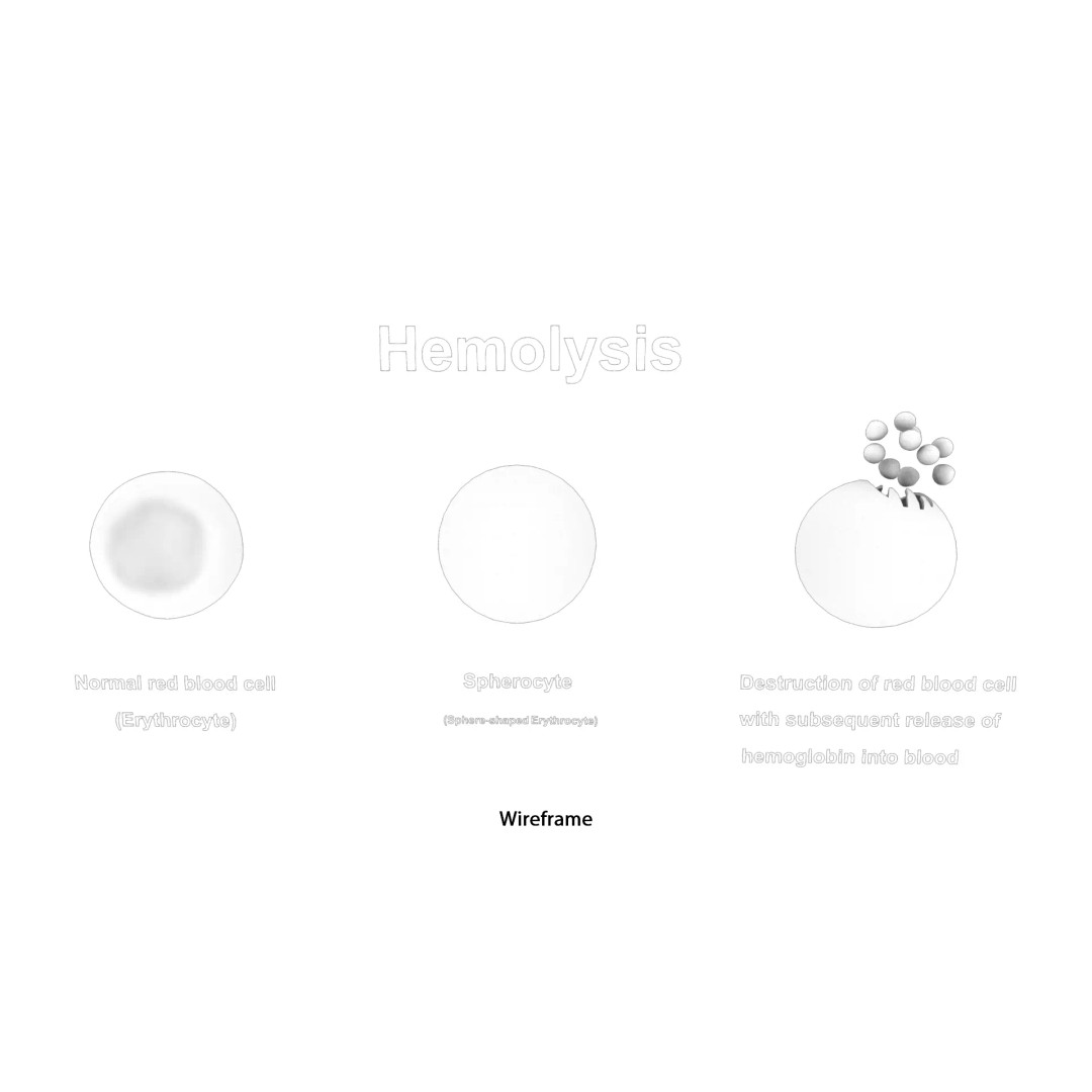 Hemolysis 3D Model – PBR Medical Asset, FBX, OBJ, Blender - View 6
