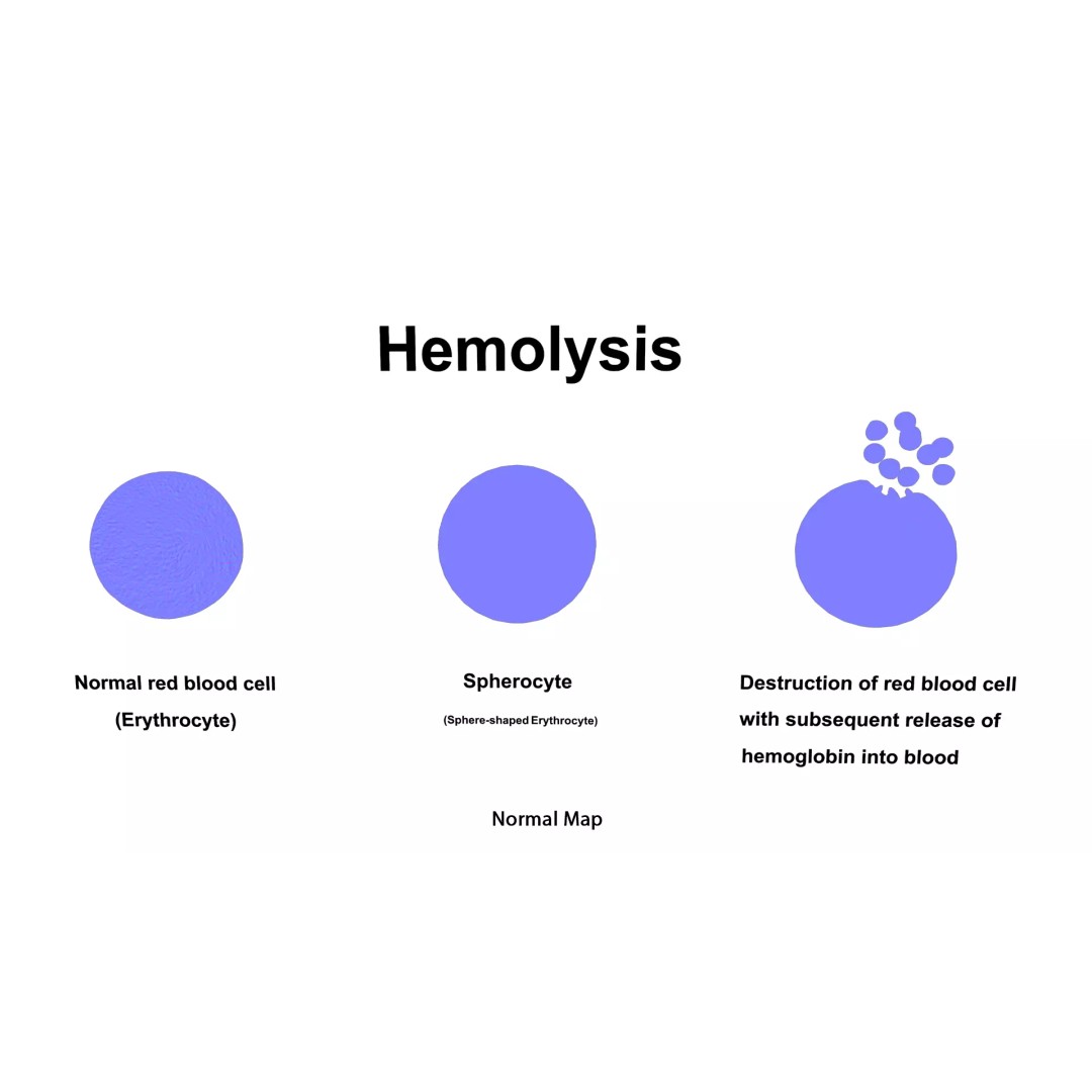 Hemolysis 3D Model – PBR Medical Asset, FBX, OBJ, Blender - View 7