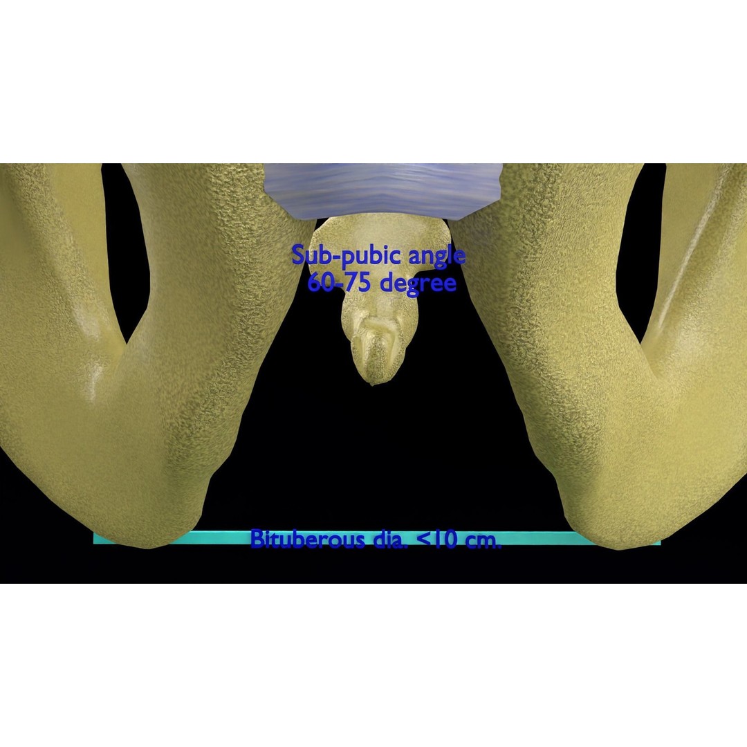 Pelvis Types 3D Model – Detailed Anatomical Representation, Blender, FBX - View 13