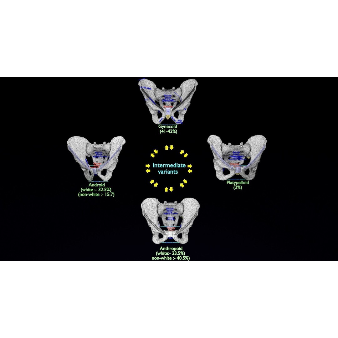 Pelvis Types 3D Model – Detailed Anatomical Representation, Blender, FBX - View 20