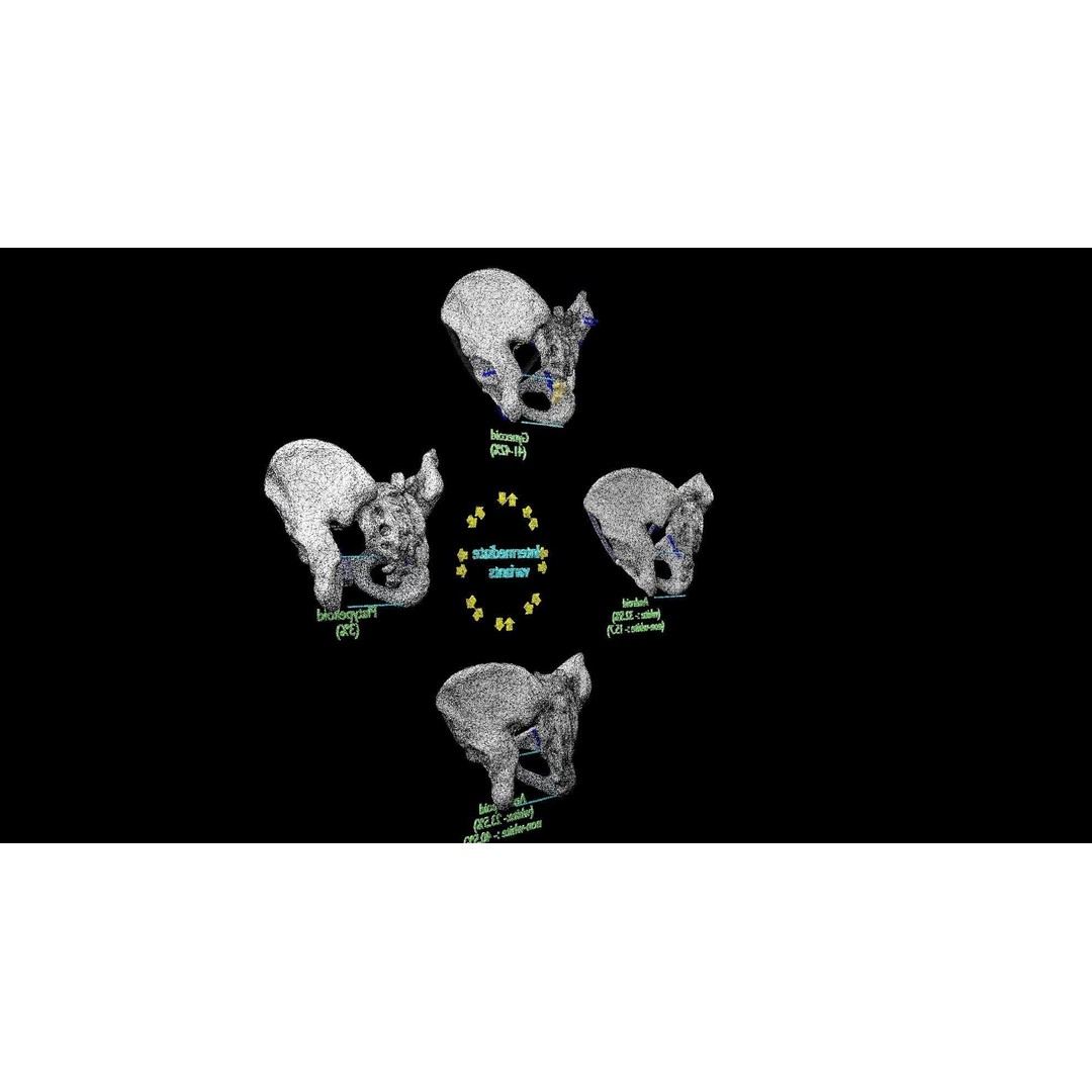 Pelvis Types 3D Model – Detailed Anatomical Representation, Blender, FBX - View 28