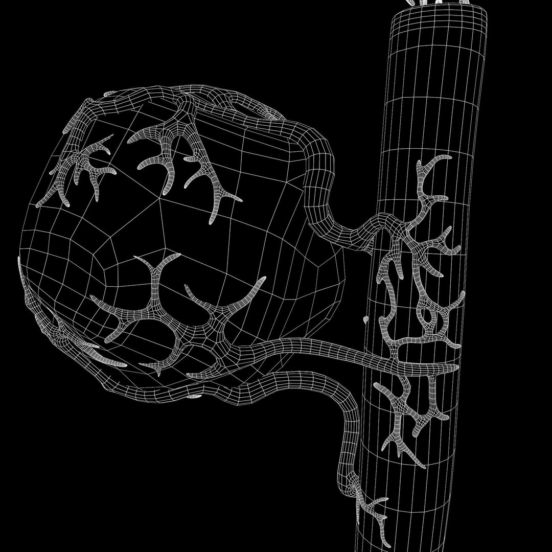 Tumor 3D Model – Low Poly Anatomy Asset with PBR Textures - View 11