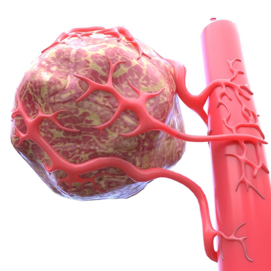 Tumor 3D Model – Low Poly Anatomy Asset with PBR Textures - View 4
