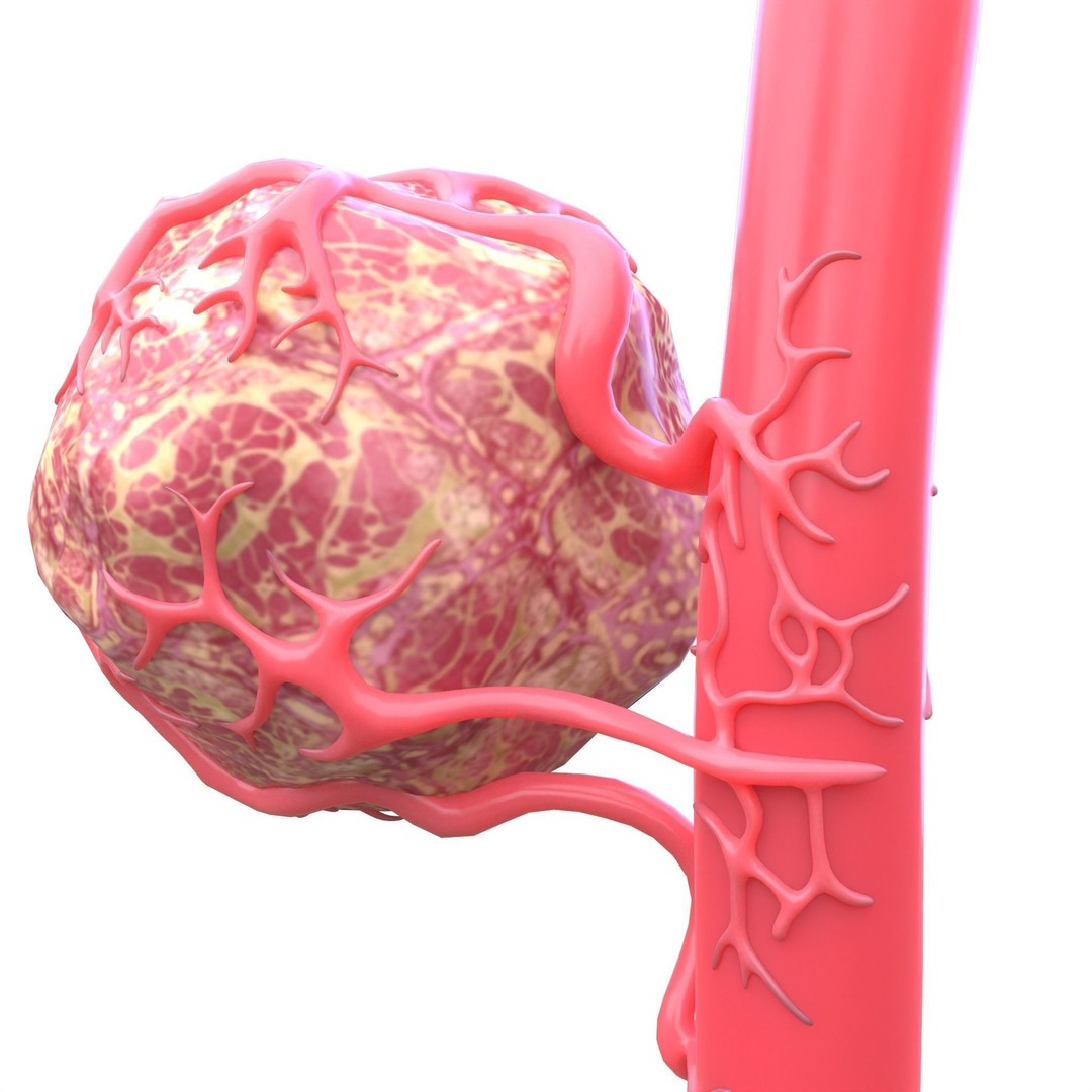 Tumor 3D Model – Low Poly Anatomy Asset with PBR Textures - View 5