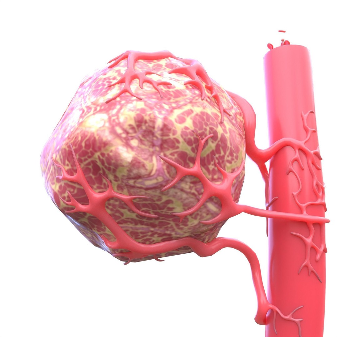 Tumor 3D Model – Low Poly Anatomy Asset with PBR Textures - View 6
