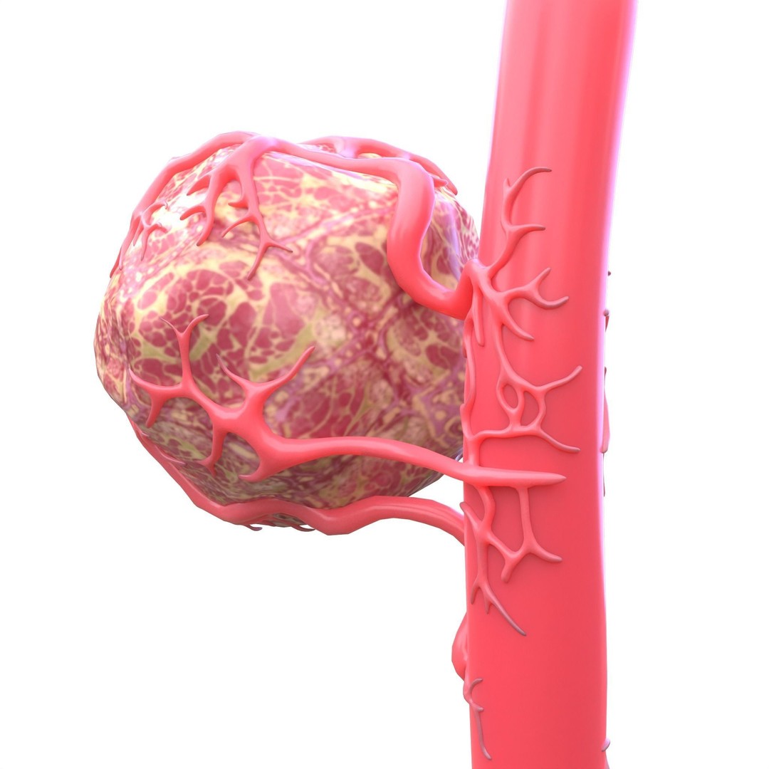 Tumor 3D Model – Low Poly Anatomy Asset with PBR Textures - View 7