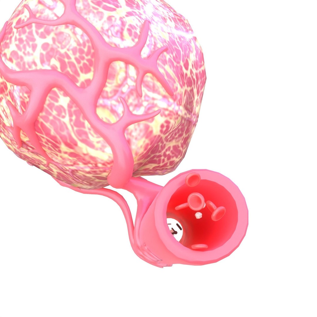Tumor 3D Model – Low Poly Anatomy Asset with PBR Textures - View 8