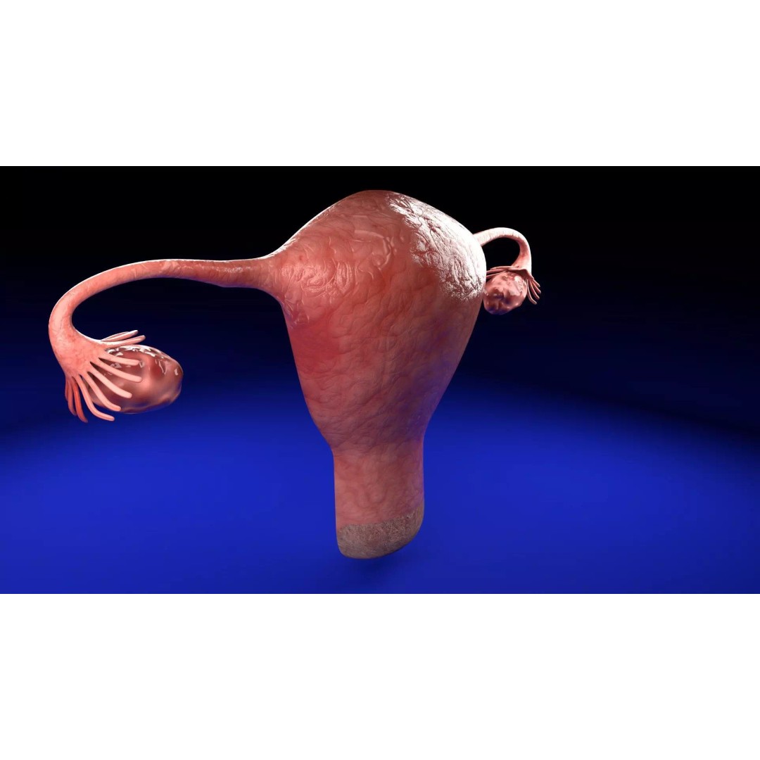 Uterus 3D Model – Low Poly Endometrial Lesions Set for Medical Use - View 13