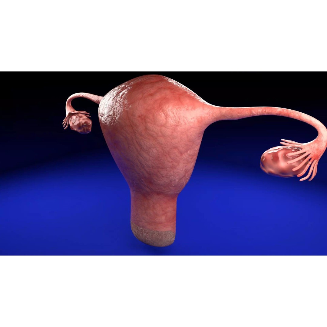 Uterus 3D Model – Low Poly Endometrial Lesions Set for Medical Use - View 15