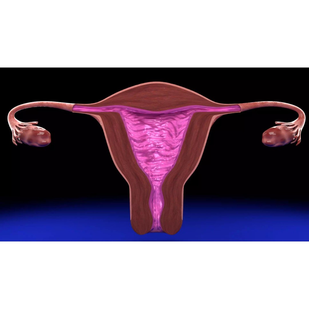 Uterus 3D Model – Low Poly Endometrial Lesions Set for Medical Use - View 22