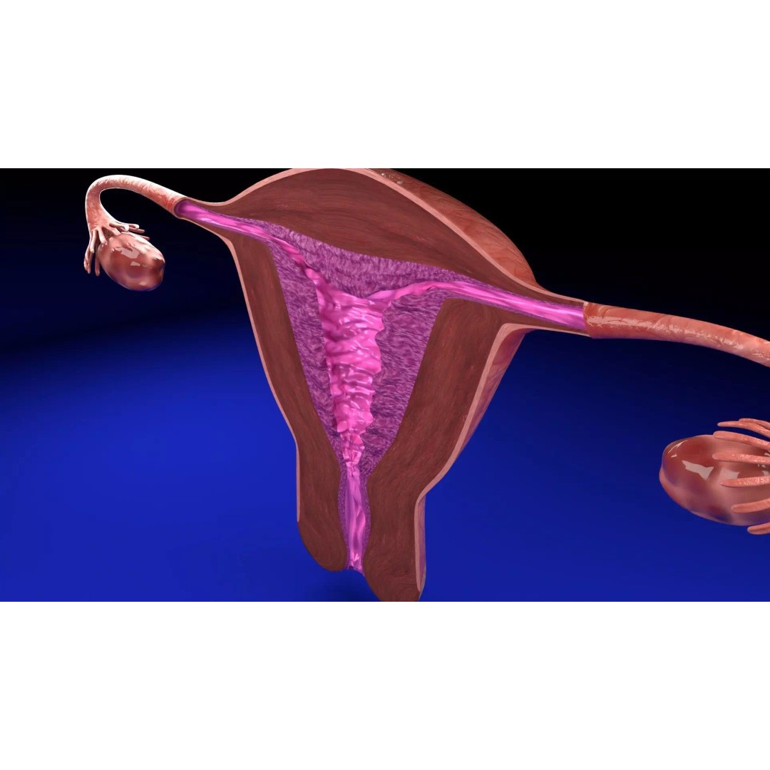 Uterus 3D Model – Low Poly Endometrial Lesions Set for Medical Use - View 25