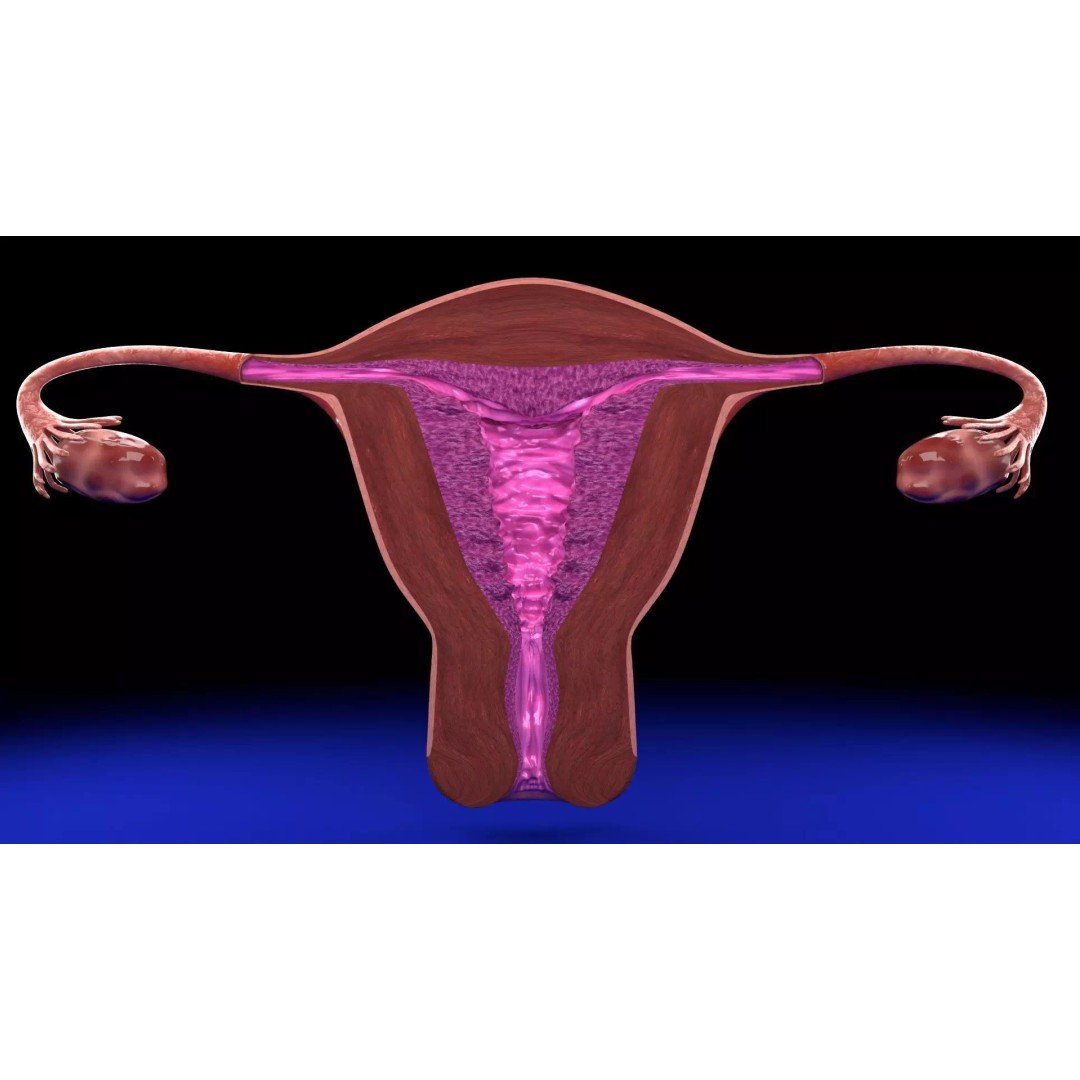 Uterus 3D Model – Low Poly Endometrial Lesions Set for Medical Use - View 28
