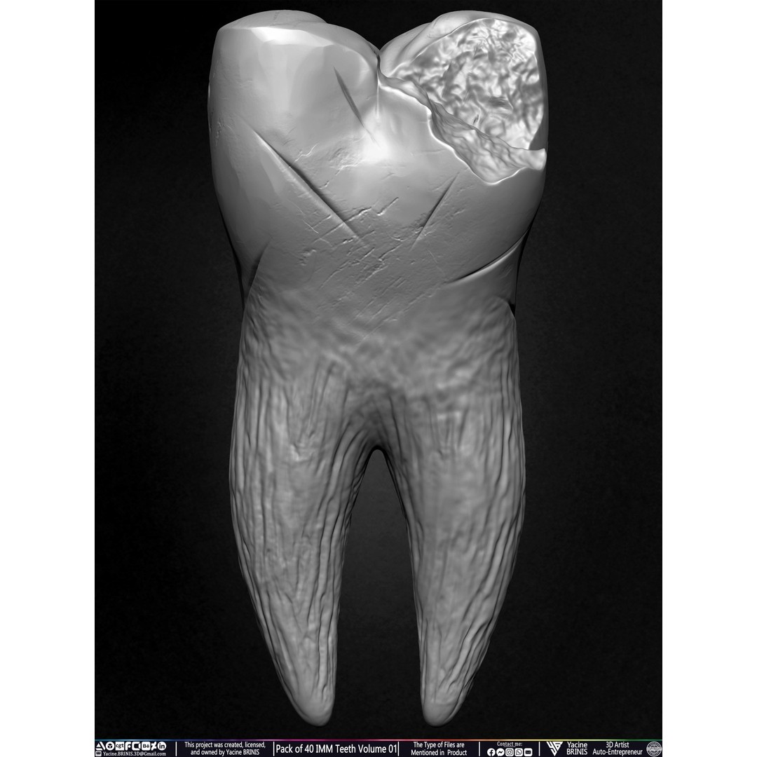 Pack of 40 IMM Teeth 3D Model – Anatomically Inspired Dental Assets for ZBrush - View 45
