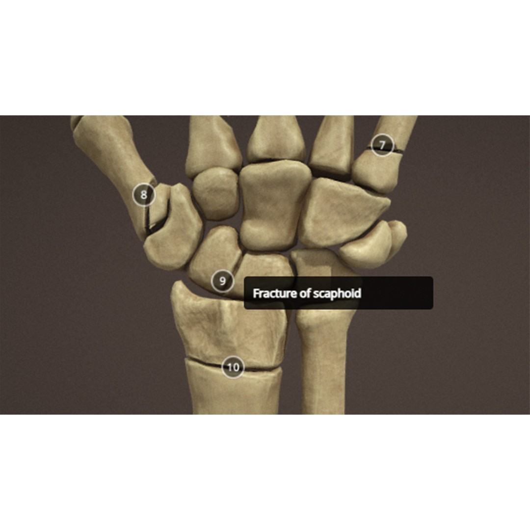 Hand Anatomy 3D Model – Low Poly Character Asset with PBR Textures - View 15