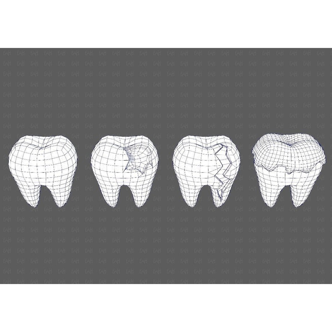 Teeth Cartoon 3D Model – Low Poly Game Asset, FBX, PBR Textures - View 27