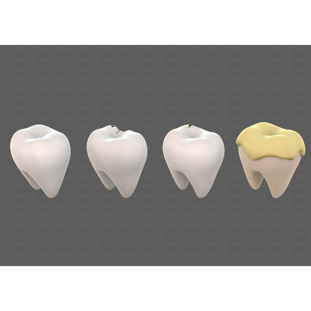 Teeth Cartoon 3D Model – Low Poly Game Asset, FBX, PBR Textures - View 6