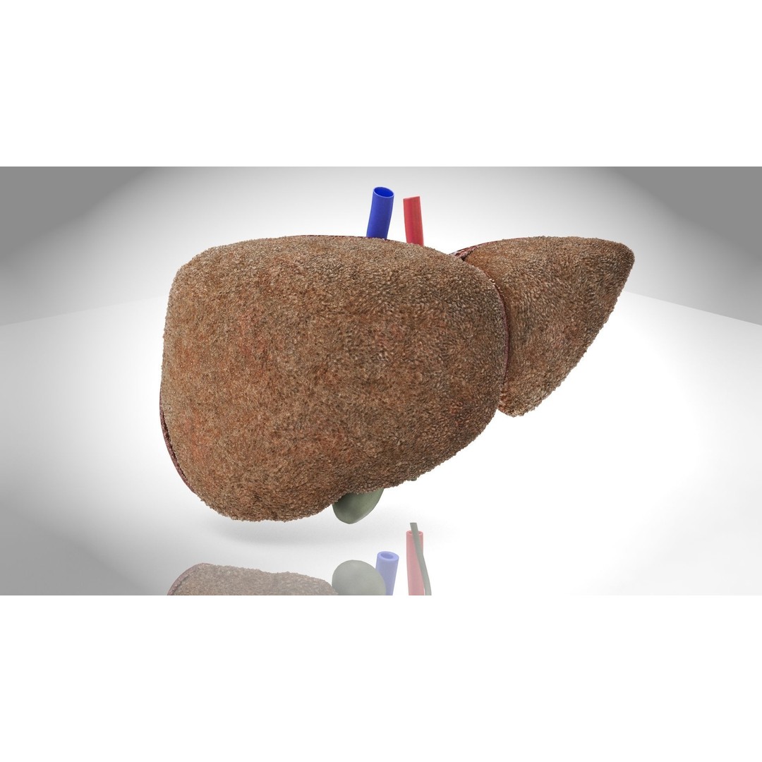 Steatohepatitis Liver 3D Model – Low Poly Medical Asset, PBR Textures - View 11