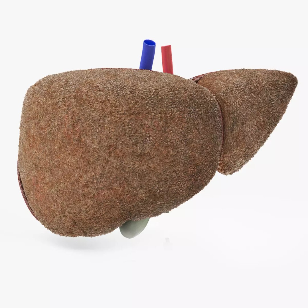 Steatohepatitis Liver 3D Model – Low Poly Medical Asset, PBR Textures - View 2