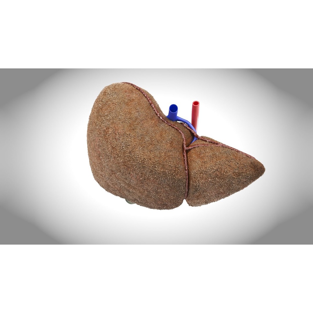 Steatohepatitis Liver 3D Model – Low Poly Medical Asset, PBR Textures - View 3