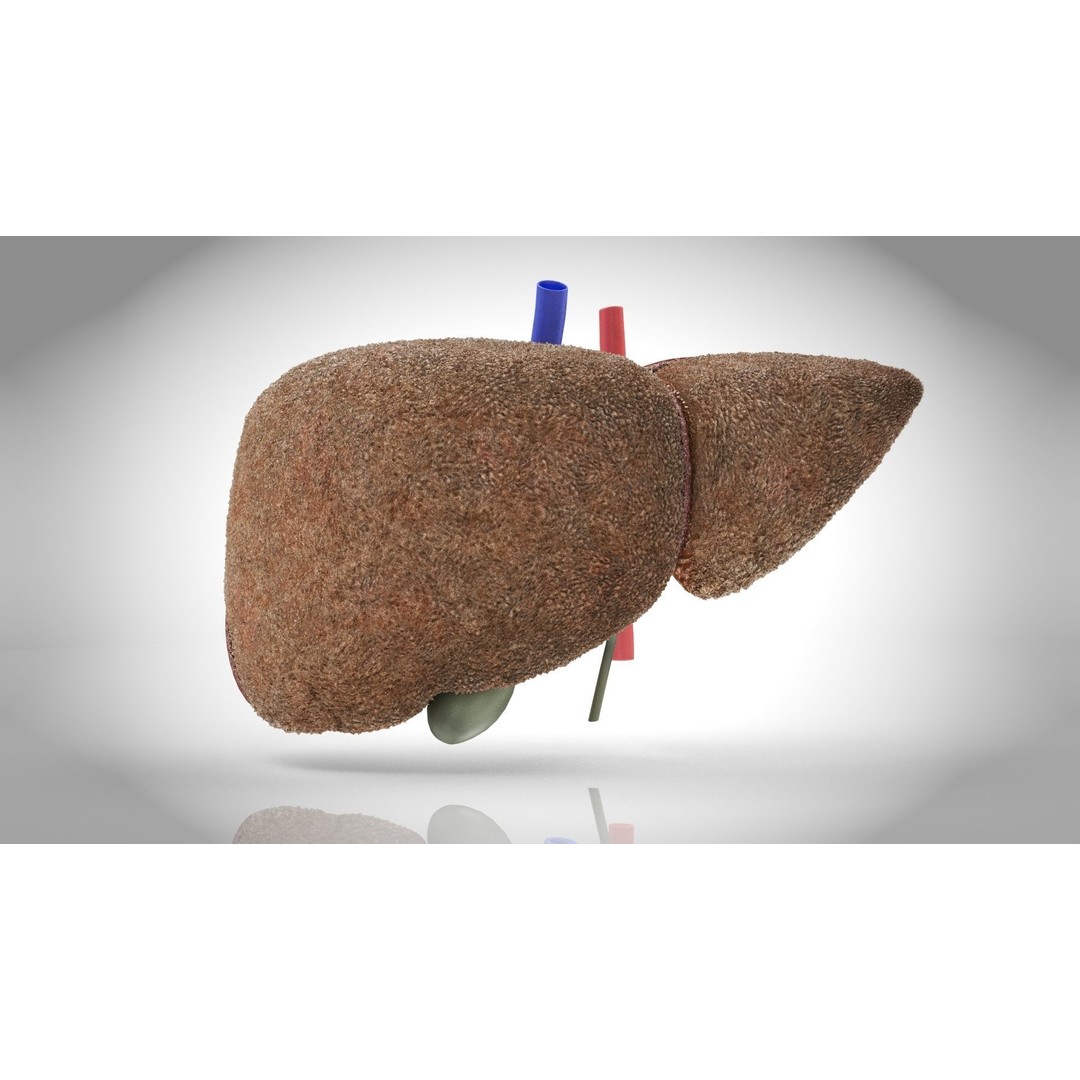 Steatohepatitis Liver 3D Model – Low Poly Medical Asset, PBR Textures - View 4