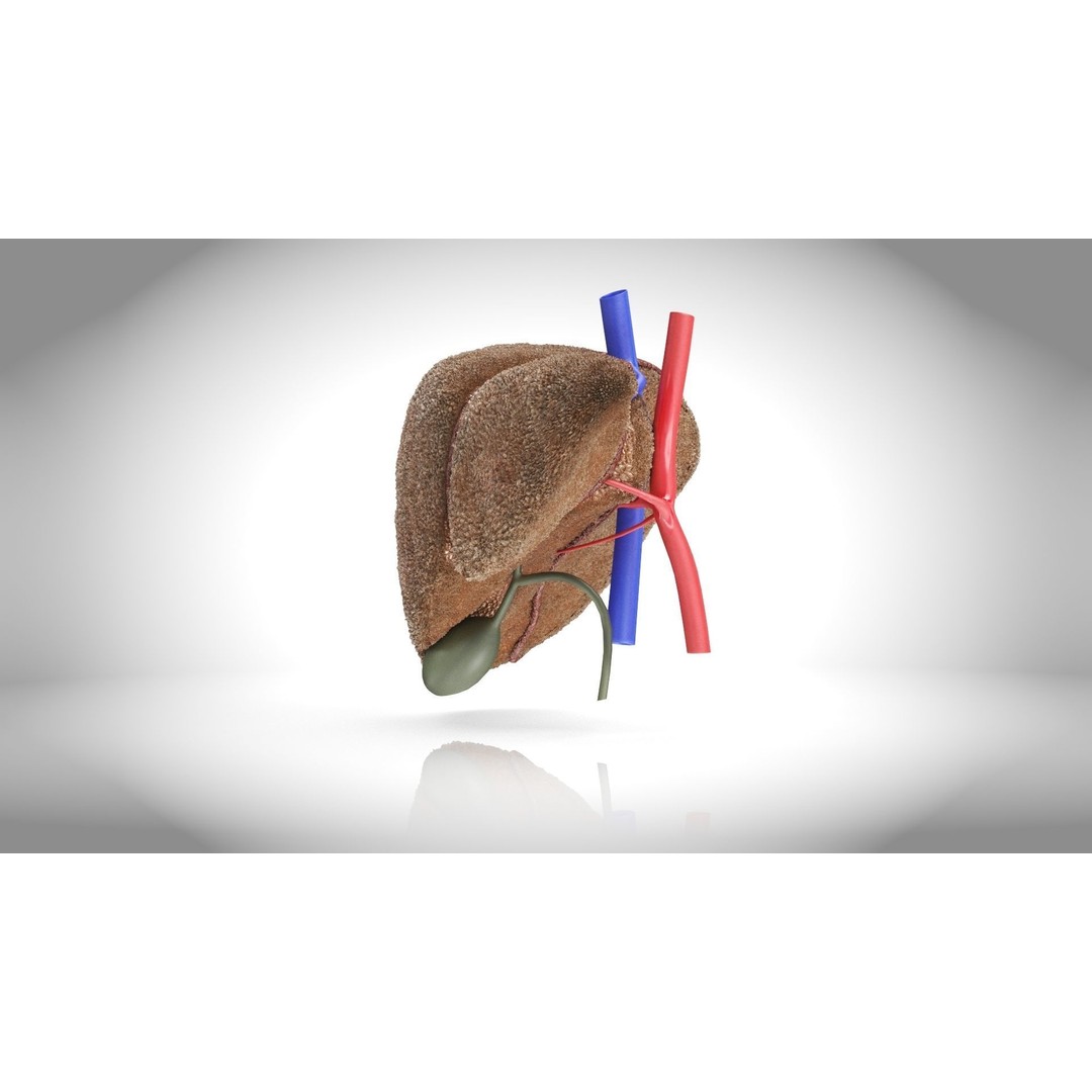 Steatohepatitis Liver 3D Model – Low Poly Medical Asset, PBR Textures - View 5
