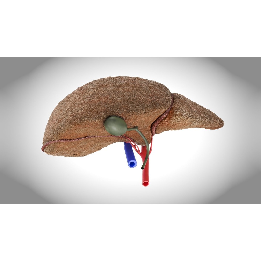 Steatohepatitis Liver 3D Model – Low Poly Medical Asset, PBR Textures - View 6