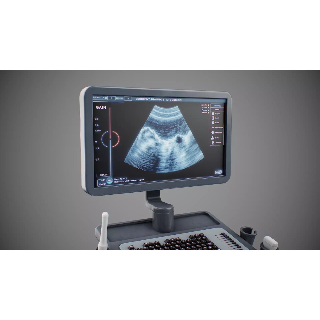 Ultrasound Machine 3D Model – Low Poly Game Ready Asset, FBX, OBJ - View 11