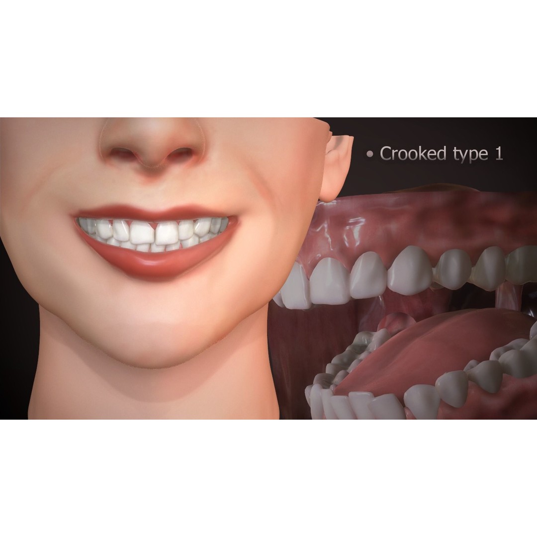 Great Teeth Collection 3D Model – Low-Poly Character Mouth, FBX & OBJ - View 19