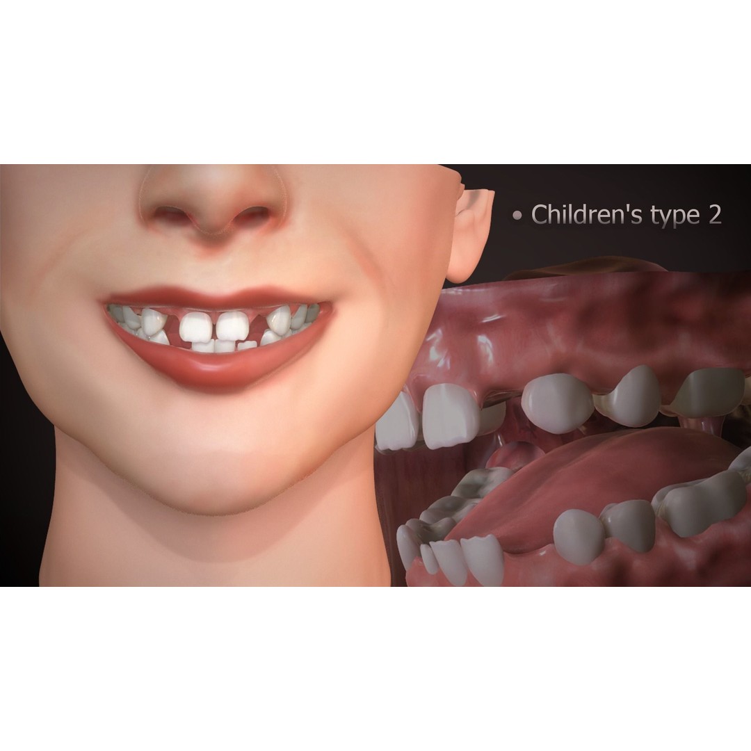 Great Teeth Collection 3D Model – Low-Poly Character Mouth, FBX & OBJ - View 21
