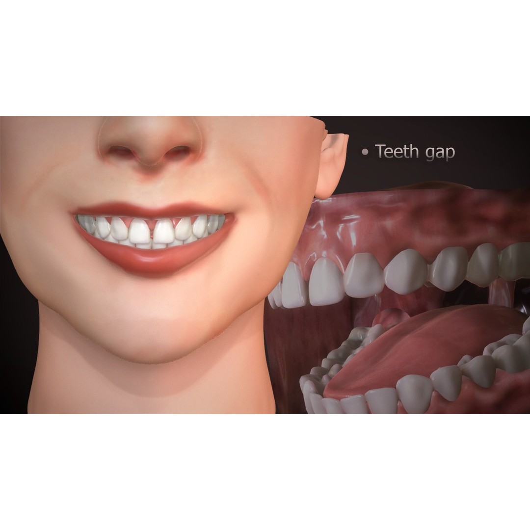 Great Teeth Collection 3D Model – Low-Poly Character Mouth, FBX & OBJ - View 24