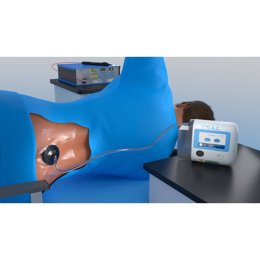 VAC Medical Device 3D Model – Rigged Low Poly Asset, FBX, OBJ - View 19