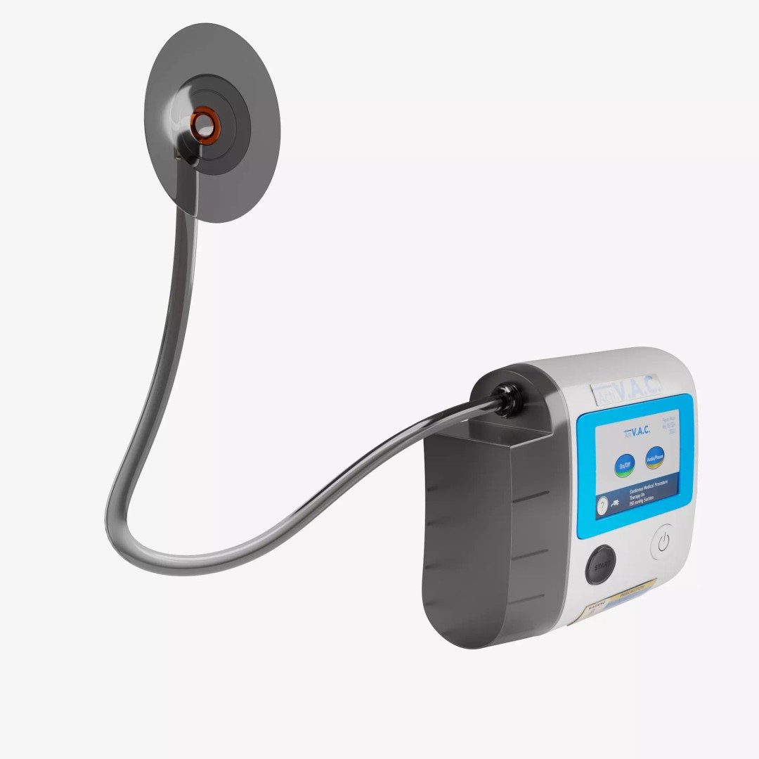 VAC Medical Device 3D Model – Rigged Low Poly Asset, FBX, OBJ - View 2