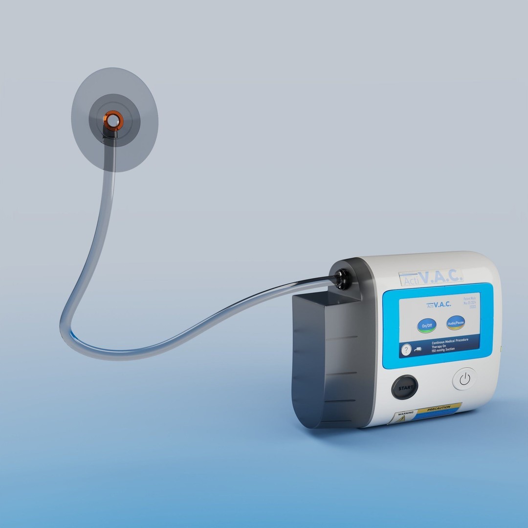 VAC Medical Device 3D Model – Rigged Low Poly Asset, FBX, OBJ - View 4