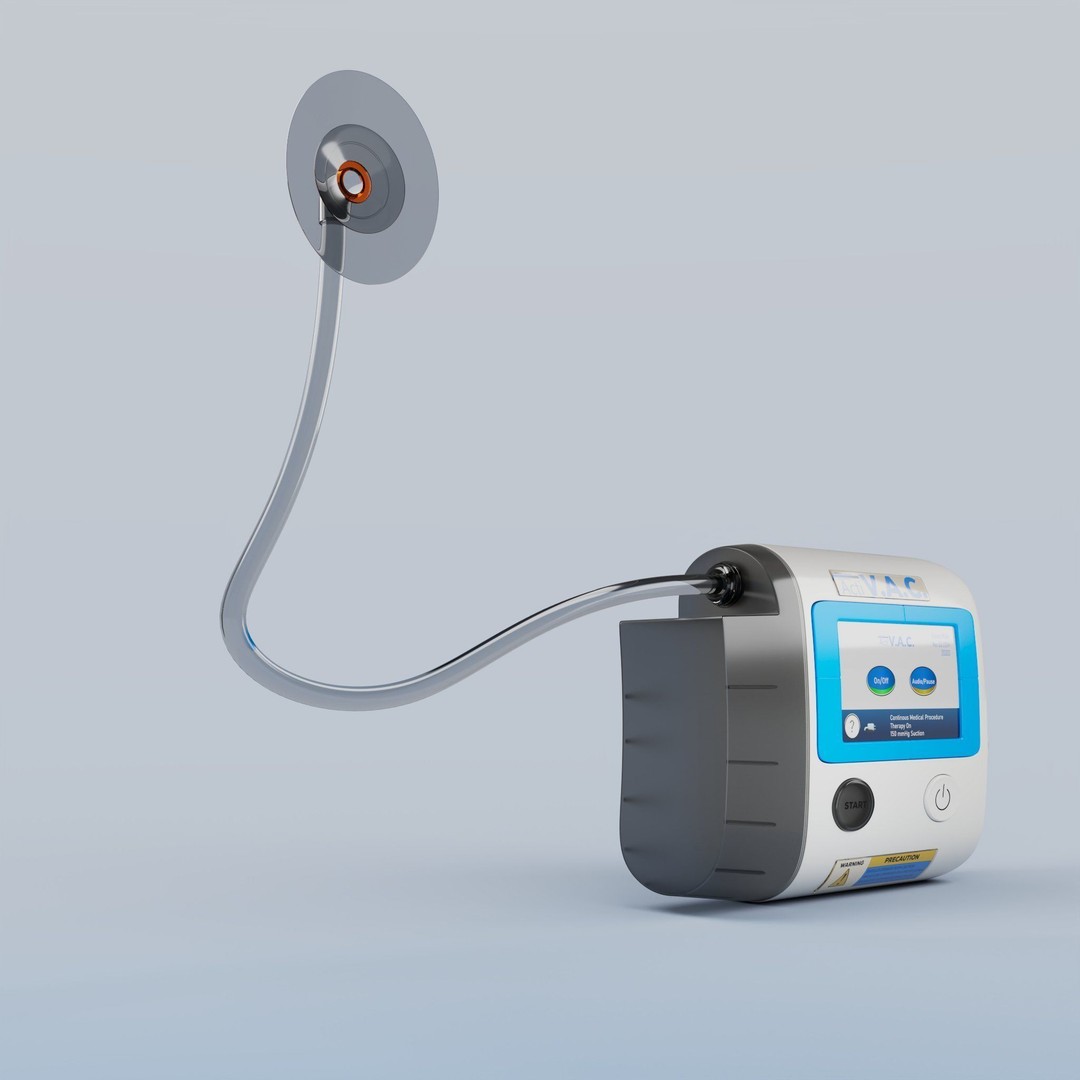 VAC Medical Device 3D Model – Rigged Low Poly Asset, FBX, OBJ - View 5